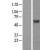 Western Blot: PHACS Lysate [NBL1-07234] - Western Blot experiments. 
Left-Control; Right -Over-expression Lysate for ACCS